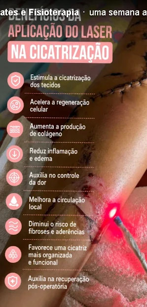 Laserterapia para cicatrização